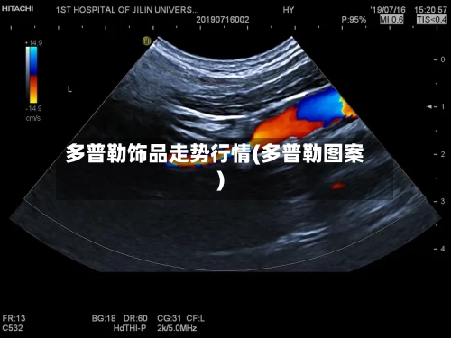 多普勒饰品走势行情(多普勒图案)