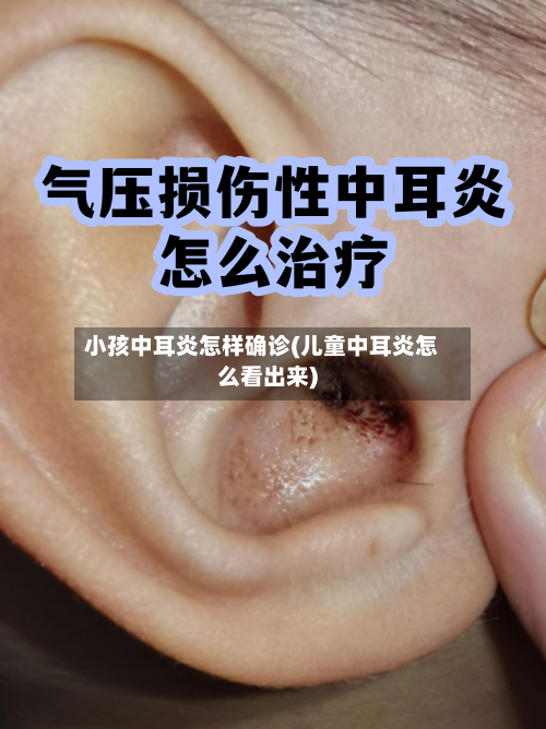 小孩中耳炎怎样确诊(儿童中耳炎怎么看出来)