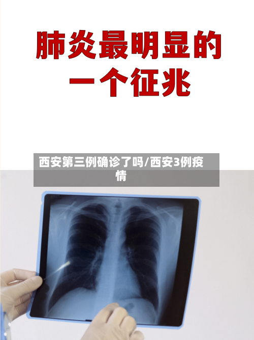 西安第三例确诊了吗/西安3例疫情