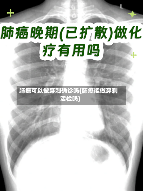肺癌可以做穿刺确诊吗(肺癌能做穿刺活检吗)