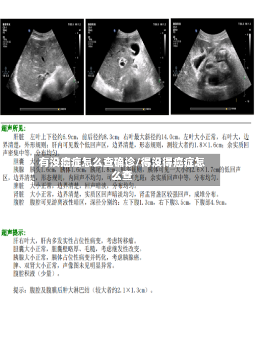 有没癌症怎么查确诊/得没得癌症怎么查