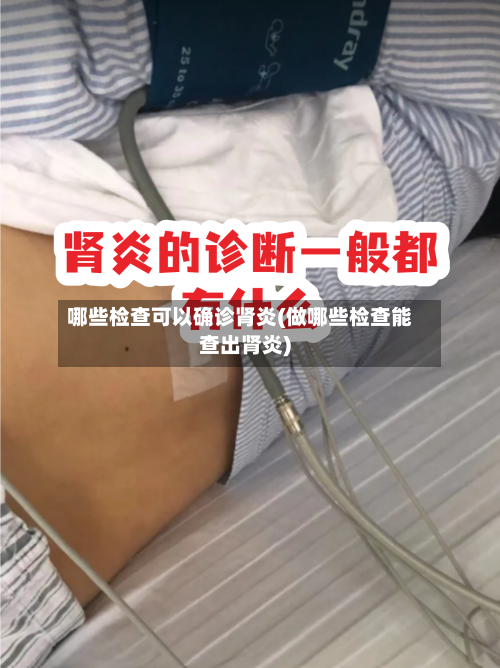 哪些检查可以确诊肾炎(做哪些检查能查出肾炎)