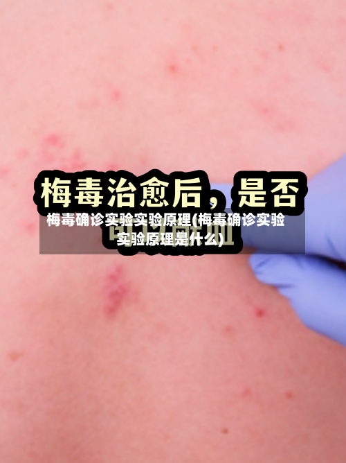 梅毒确诊实验实验原理(梅毒确诊实验实验原理是什么)