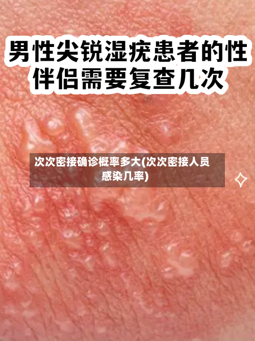 次次密接确诊概率多大(次次密接人员感染几率)