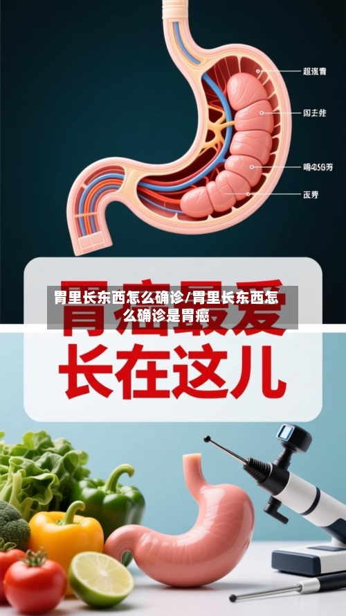 胃里长东西怎么确诊/胃里长东西怎么确诊是胃癌