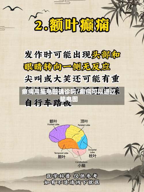 癫痫用脑电图确诊吗/癫痫可以通过脑电图