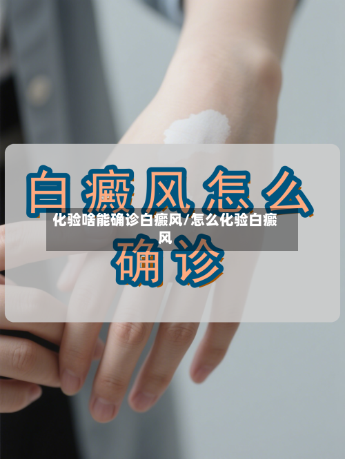 化验啥能确诊白癜风/怎么化验白癜风