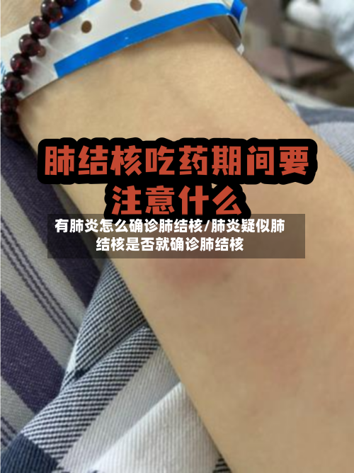 有肺炎怎么确诊肺结核/肺炎疑似肺结核是否就确诊肺结核