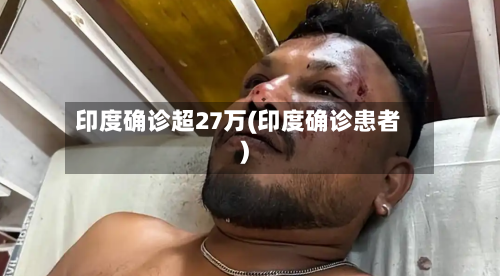 印度确诊超27万(印度确诊患者)