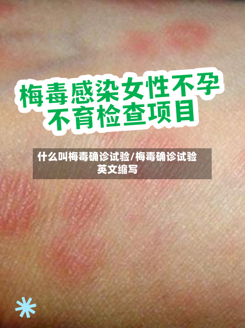什么叫梅毒确诊试验/梅毒确诊试验英文缩写