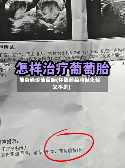 能否确诊葡萄胎(怀疑葡萄胎但化验又不是)