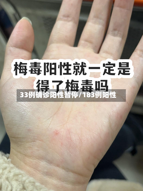 33例确诊阳性暂停/183例阳性
