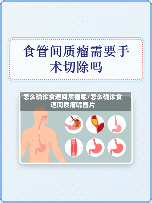 怎么确诊食道间质瘤呢/怎么确诊食道间质瘤呢图片