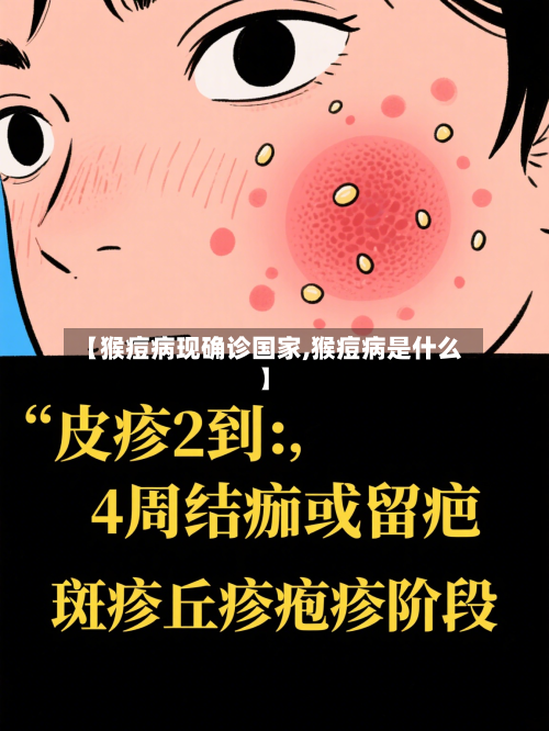 【猴痘病现确诊国家,猴痘病是什么】