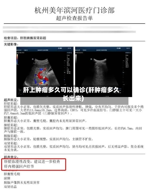 肝上肿瘤多久可以确诊(肝肿瘤多久长出来)
