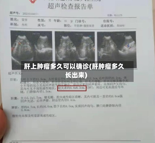 肝上肿瘤多久可以确诊(肝肿瘤多久长出来)