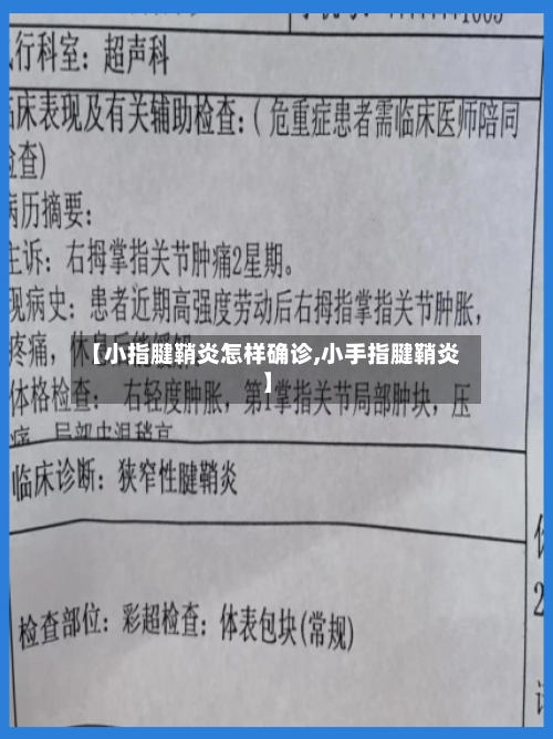 【小指腱鞘炎怎样确诊,小手指腱鞘炎】