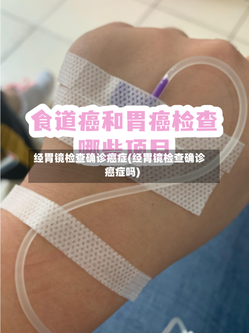 经胃镜检查确诊癌症(经胃镜检查确诊癌症吗)