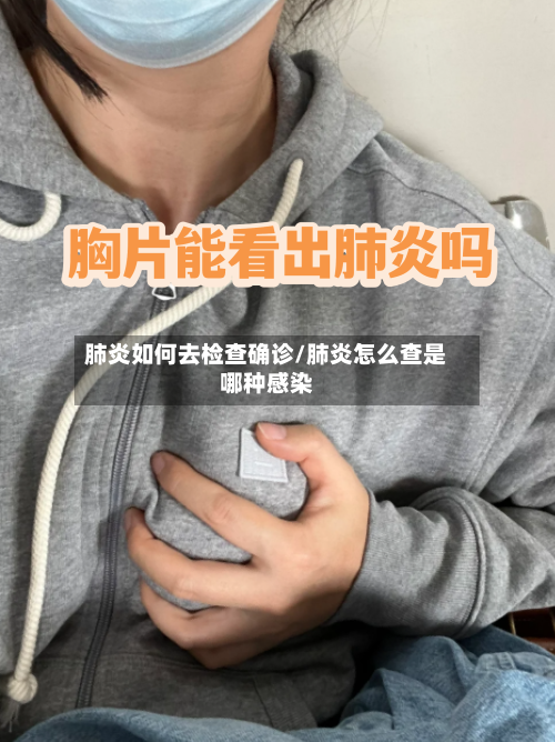 肺炎如何去检查确诊/肺炎怎么查是哪种感染
