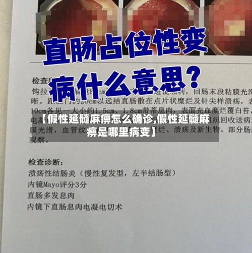 【假性延髓麻痹怎么确诊,假性延髓麻痹是哪里病变】