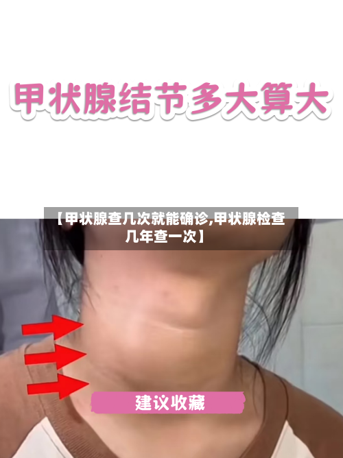 【甲状腺查几次就能确诊,甲状腺检查几年查一次】