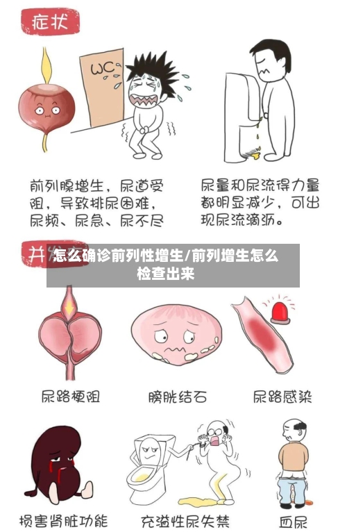 怎么确诊前列性增生/前列增生怎么检查出来