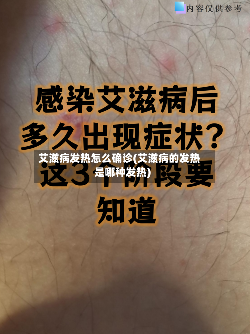 艾滋病发热怎么确诊(艾滋病的发热是哪种发热)