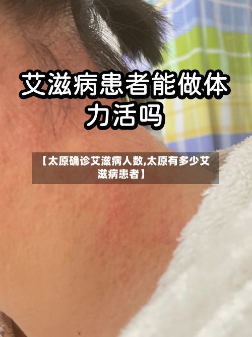 【太原确诊艾滋病人数,太原有多少艾滋病患者】