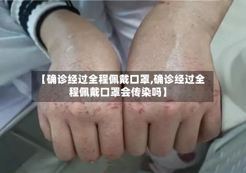 【确诊经过全程佩戴口罩,确诊经过全程佩戴口罩会传染吗】