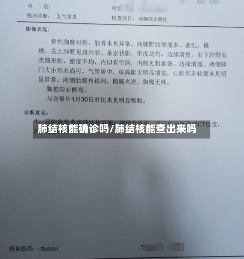 肺结核能确诊吗/肺结核能查出来吗