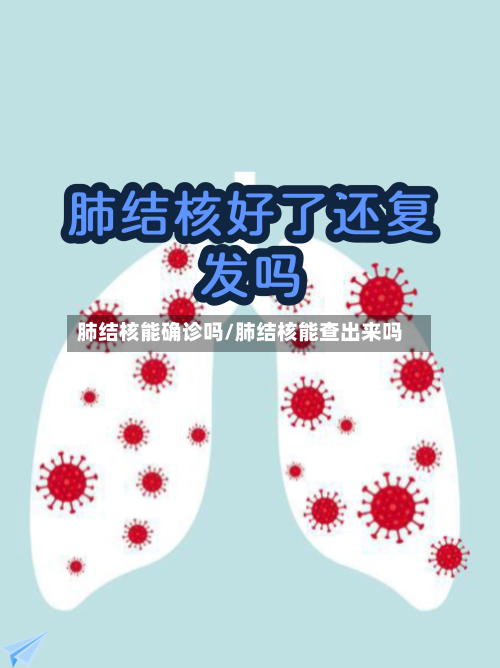 肺结核能确诊吗/肺结核能查出来吗