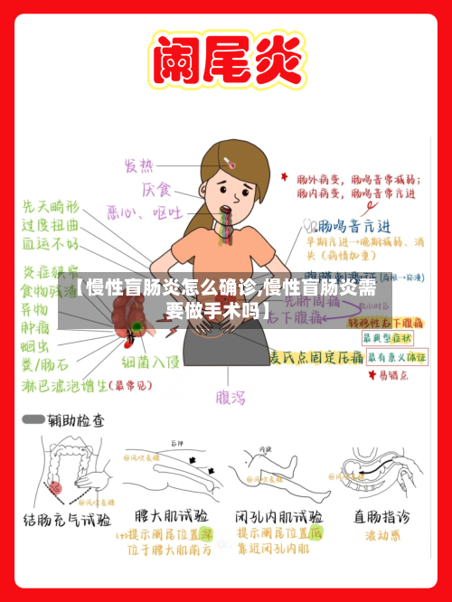 【慢性盲肠炎怎么确诊,慢性盲肠炎需要做手术吗】