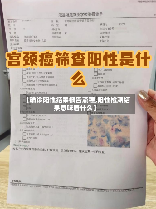 【确诊阳性结果报告流程,阳性检测结果意味着什么】