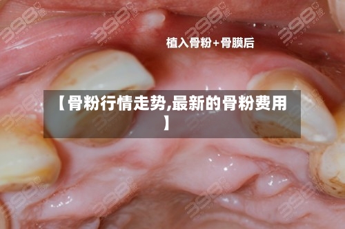【骨粉行情走势,最新的骨粉费用】