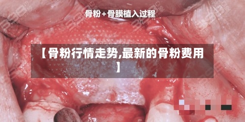 【骨粉行情走势,最新的骨粉费用】