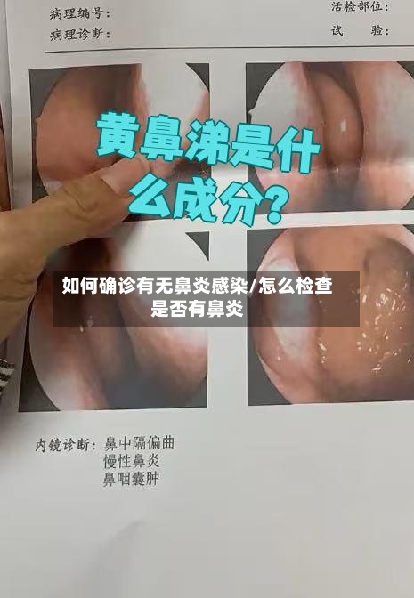 如何确诊有无鼻炎感染/怎么检查是否有鼻炎