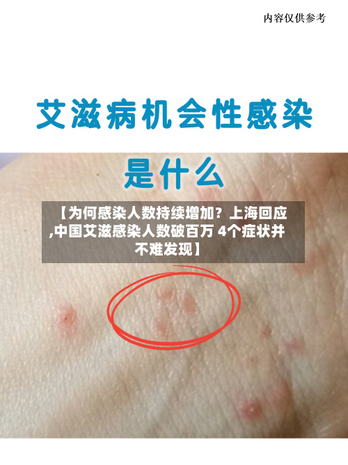 【为何感染人数持续增加?上海回应,中国艾滋感染人数破百万 4个症状并不难发现】